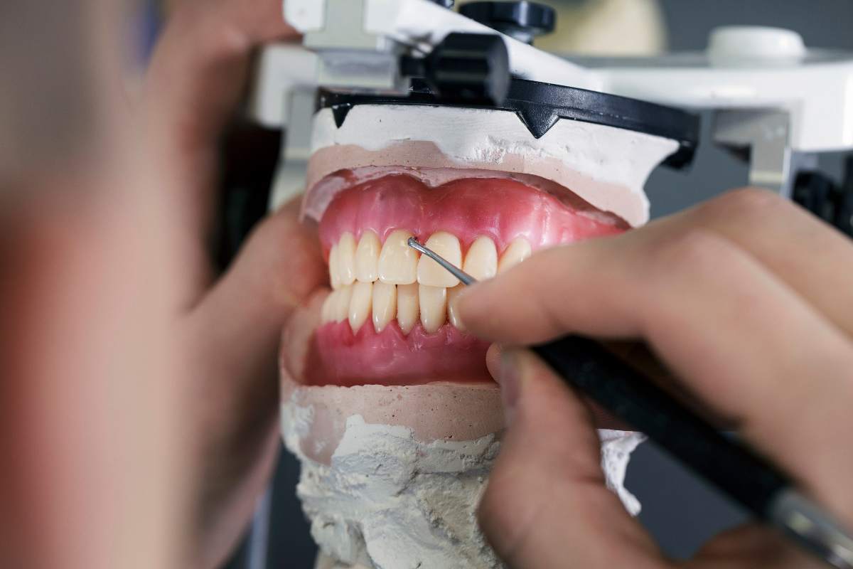 Protesi dentarie in Albania
